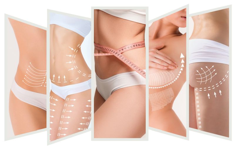 Body Contouring