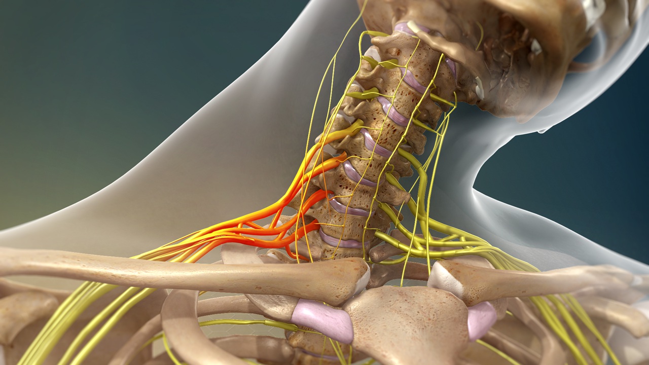 Brachial Plexus Injuries