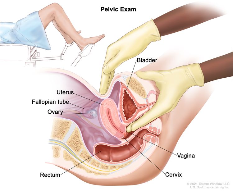 Cervical Agenesis