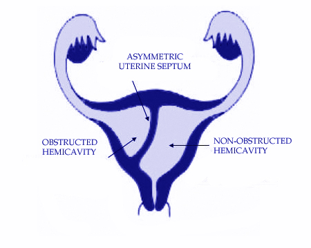 Robert Uterus